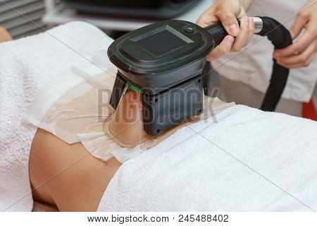 Woman Getting Cryolipolysis Fat Treatment Procedure In Professional Cosmetic Cabinet Or Spa Center, 