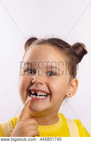 Pretty Girl With Opened Mouth Pointing At Missing Front Milk Tooth With Finger Smiling Crazily And L
