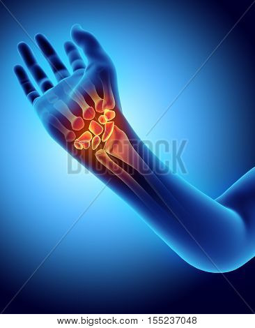 3D Illustration Of Carpal, Medical Concept.