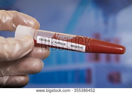 Humand Hand With Blood Sample Tube Positive With Covid-19 Or Novel Coronavirus