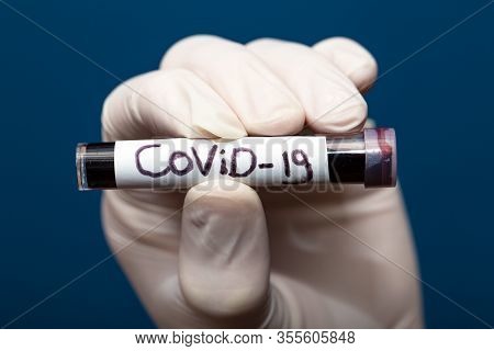 Convid-19 Blood Sample, Doctor Wearing Medical Gloves Holding A Blood Tube With Positive Coronavirus