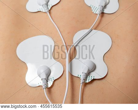 Treatment And Relaxation Of Muscles On The Human Body With The Help Of An Electronic Apunctuator Med