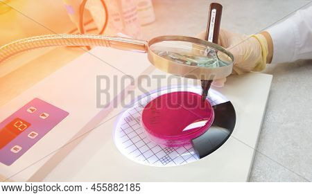 A Scientist Calculated That A Colony Of Escherichia Coli Bacteria Cultured On Eosin-methylene Blue A