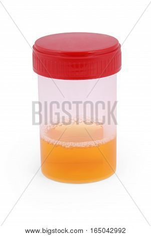 Sterile Medical container for urine with biomaterial. Clipping path inside.