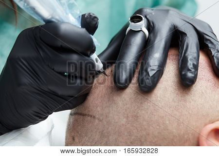 Cosmetologist making permanent makeup on man head - tricopigmentation