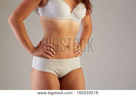 Unretouched skin exhibits stretch marks and other imperfections.