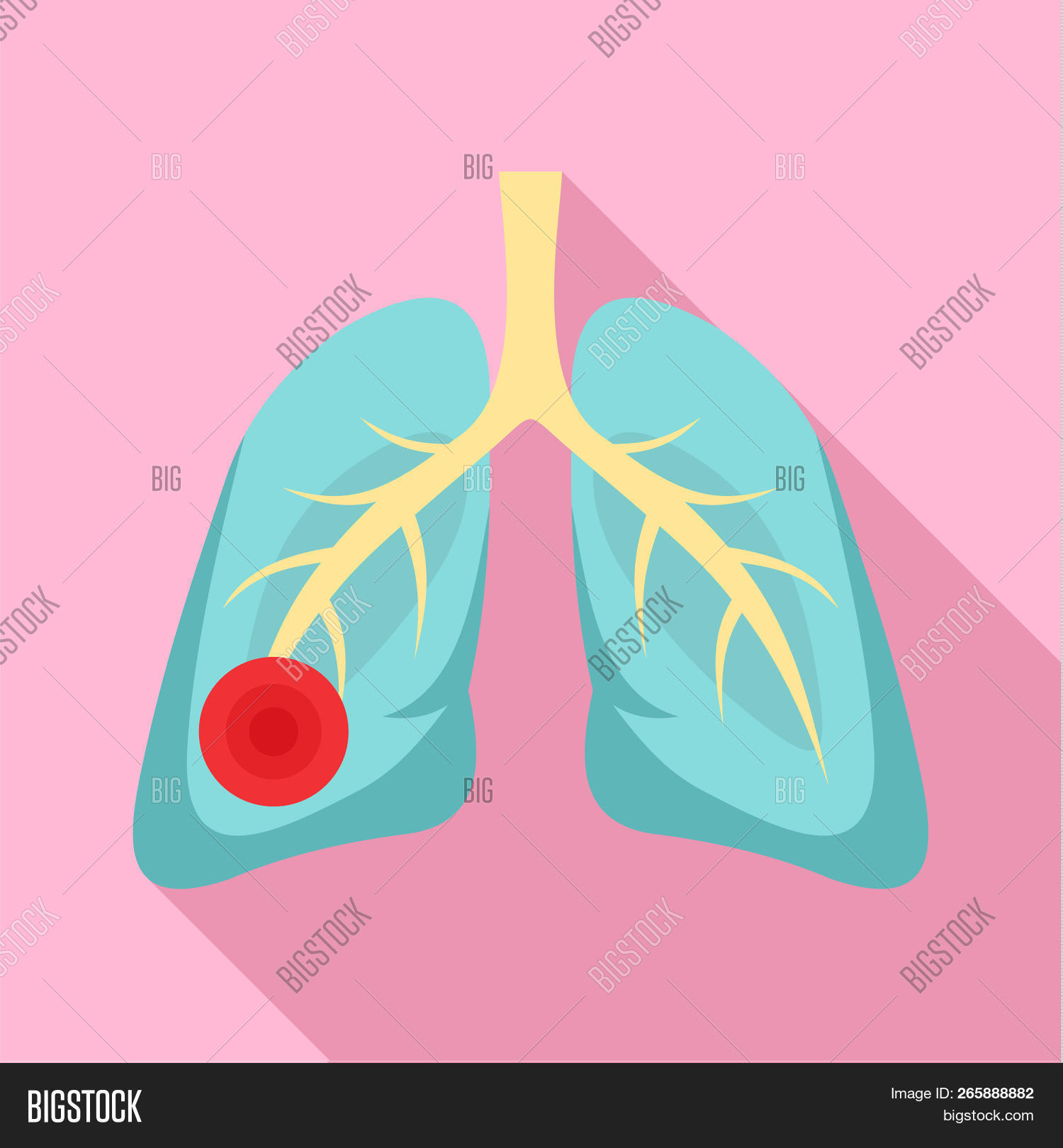 рак легких рисунок