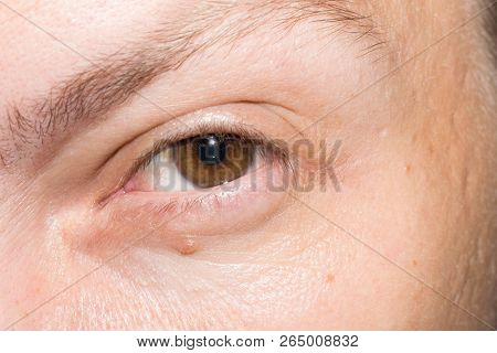Brown Color Adult Male Eye For Design Medicine