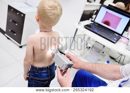 Doctor Examines The Special Medical Device Moles Child