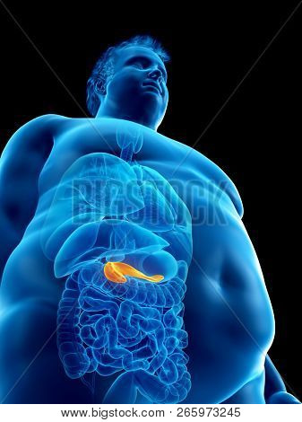 3d rendered medically accurate illustration of an obese mans pancreas