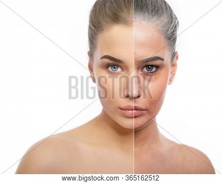 Beautiful young girl with half face of old tired woman with wrinkles, dark circles, comedones and and gray hair. Anti-aging, beauty treatment, aging and youth, lifting, skincare, hydration, surgery 