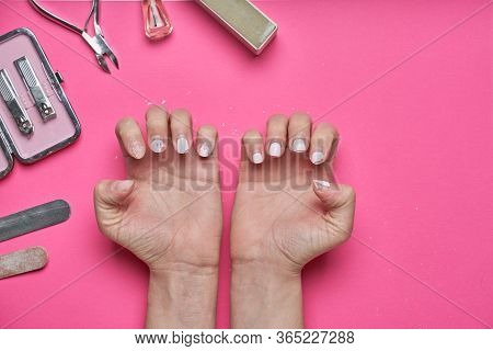 Overgrown Nails With An Old Cracked Gel Polish. Self-removal Of Old Gel Polish From Nails With A Nai
