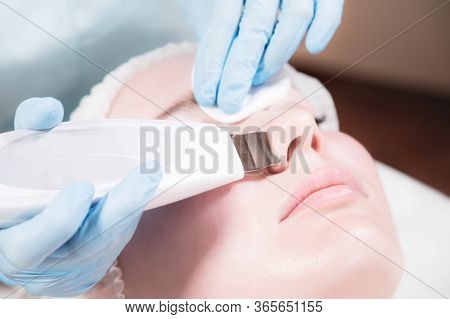Close-up Ultrasound Face Peel At The Beautician. Beautician Squeezes Acne On The Patients Forehead W
