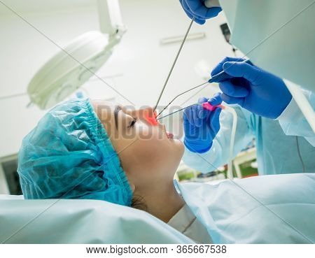 Endoscopic Sinus Surgery. Laser Vaporization Of Nasal Concha