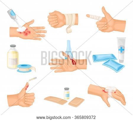Hands With Injured Skin And Procedures Of Bandaging And Wound Cleaning Vector Set
