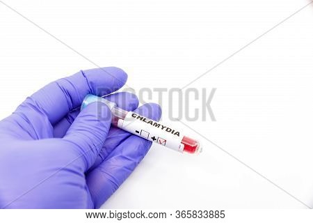 Closeup Of Microbiologist Or Medical Worker Hand With Blue Surgical Gloves Marking Blood Test Result