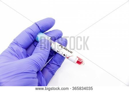 Closeup Of Microbiologist Or Medical Worker Hand With Blue Surgical Gloves Marking Blood Test Result