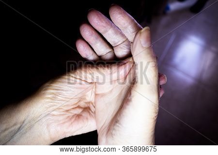 Hands Of Elderly Woman Doing A Selfmassage. Manual Physiotherapy