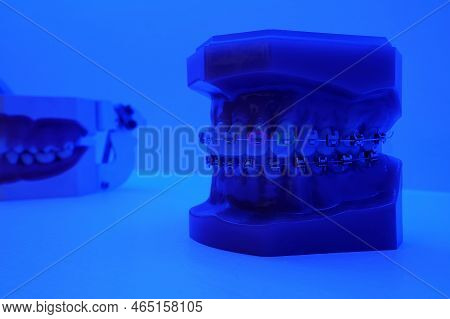 Dental Treatment Model With Metal Bracket Archwire.
