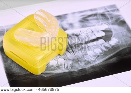 Set Of Individual Activator And Aligner For Orthodontic Treatment Correcting Deep Bite, Distal Bite,
