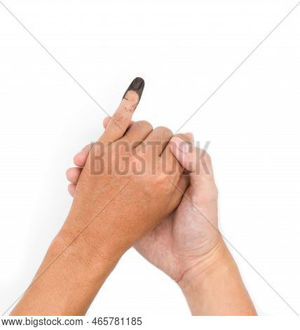 Blue Ink Mark In Little Finger Of Adult Man. Sign Of Voting In Myanmar Election.
