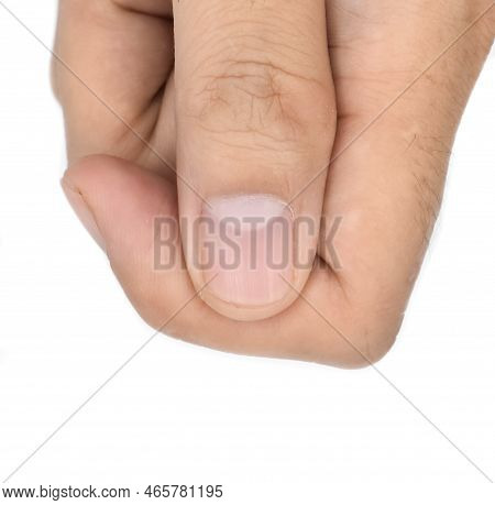 Large Lunulae Or Half-moon At Thumb Fingernail With Longitudinal Lines Of Southeast Asian, Chinese Y