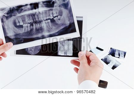 Panoramic Dental X-ray Image Of Teeth.