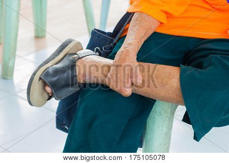 closeup foot and hand of old asian man suffering from leprosy