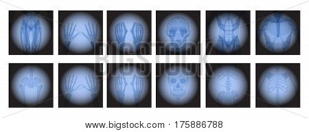 X Ray radiology set. Healthcare. Treatment for internal oragns and bones.