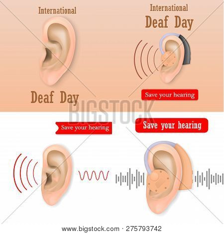 International Deaf Day Hear World Banner Concept Set. Realistic Illustration Of 4 International Deaf