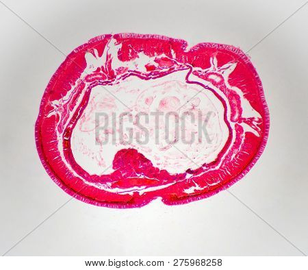 A Thin Cross Section Of A Common Earthworm Magnified Many Times For Biology