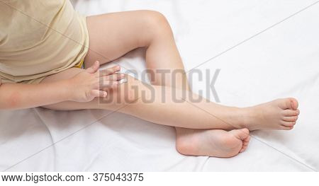 A Small Child Rubs A Childrens Healing Cream On The Skin Of A Knee. The Concept Of Treatment Of Skin