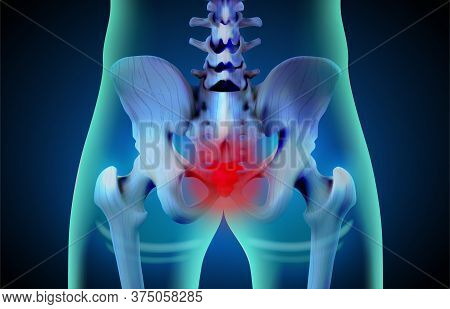 Pelvis Images Illustrations Vectors Free Bigstock