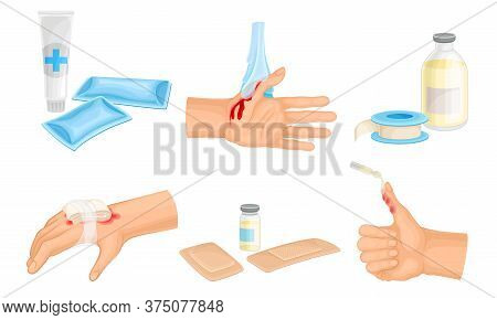 Hands With Injured Skin And Procedures Of Bandaging And Wound Cleaning Vector Set