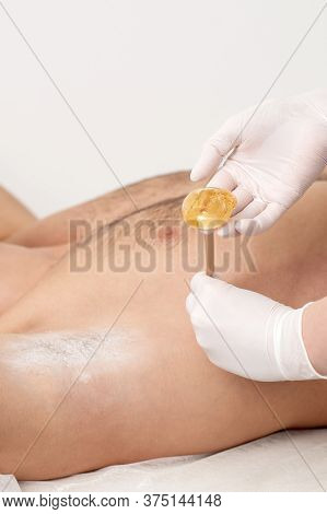 Depilation And Epilation Male Armpit With Liquid Sugar Paste By Spatula. Hand Of Cosmetologist Apply