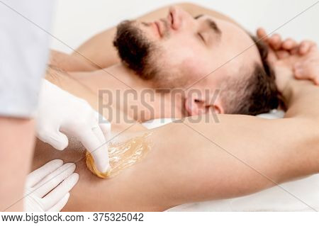 Depilation And Epilation Male Armpit With Liquid Sugar Paste. Hand Of Cosmetologist Applying Wax Pas