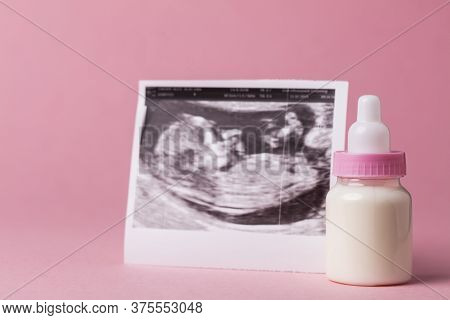 Baby Scan Ultrasound Picture. Expectant Parents Concept
