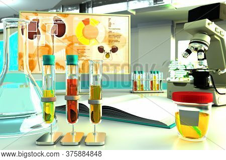 Urine Sample Test For Nitrite Or Protein In Urine Proteinuria - Laboratory Test Tubes In Biochemistr