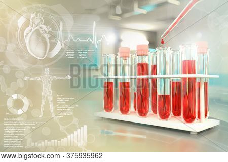 Test Tubes In Chemistry Office - Blood Sample Test For Creatinine Or Phosphorus, Medical 3d Illustra