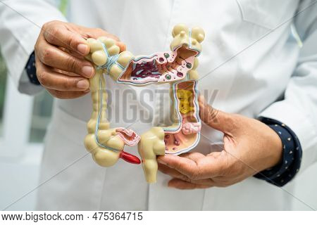 Intestine, Appendix And Digestive System, Doctor Holding Anatomy Model For Study Diagnosis And Treat