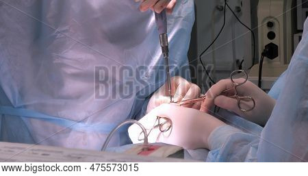 A Veterinarian Tightens A Bolt On A Plate Placed On A Pets Broken Paw In The Operating Room. A Surge
