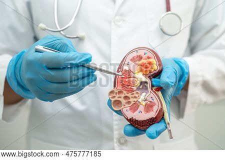 Kidney Disease, Chronic Kidney Disease Ckd, Doctor Hold Model To Study And Treat In Hospital.