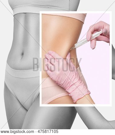 Lipolytic Injections For Burning Fat On The Abdomen, Legs And Thighs Of A Woman. Women's Aesthetic C