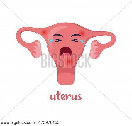Sick Uterus With Pain Ache Or Disease. Sad Cartoon Character Uterus, Body Organ Injured Or Unhealthy