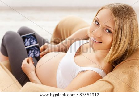 The First Photo Of My Baby.