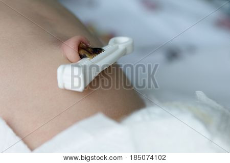 Umbilical cord with clamp of newborn baby in neonatal intensive care unit close-up