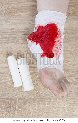 White medicine bandage on human injury foot