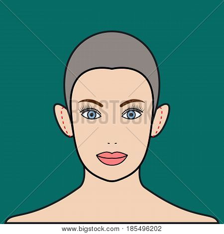 Otoplasty. Plastic surgerychange shape and size of ears. Cosmetic surgery. Vector illustration.