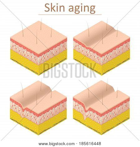 Skin Aging Set Isometric View Normal and Wrinkle Epidermis for Poster and Card. Vector illustration
