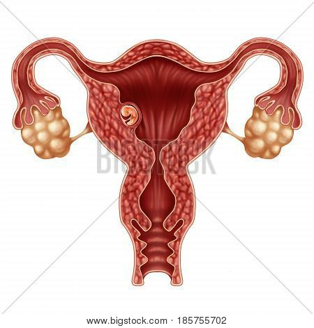 Implanted human embryo concept and successful pregnancy implantation in the uterus as a growing fetus in a female body as an obstetrics and gynecology symbol with 3D illustration elements.